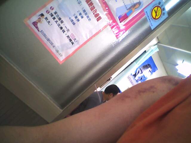 akup